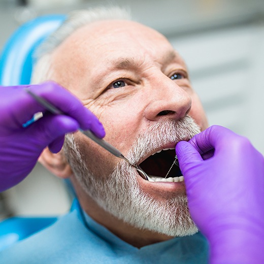 Dentist examining man's new denture