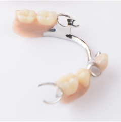 Metal partial denture