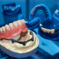 Closeup of implant dentures in Cleveland