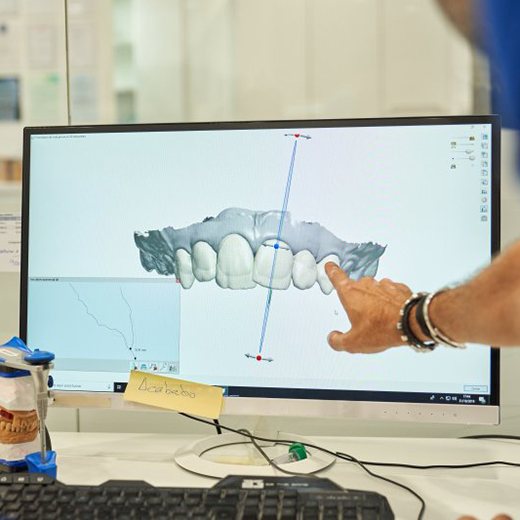 Dentist pointing at a screen to make adjustments to digital dentures