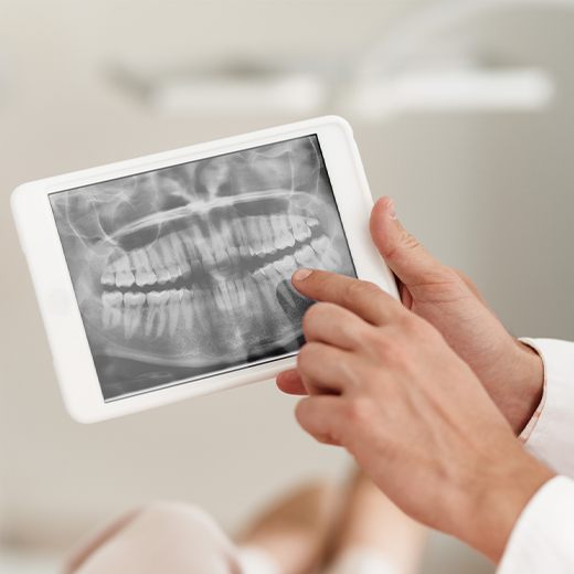 Digital dental x-rays on tablet computer