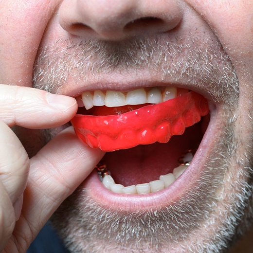 Patient placing protective mouthguard