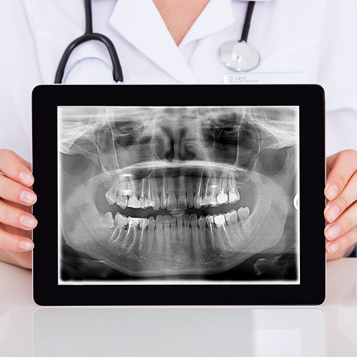 Digital x-rays on tablet computer